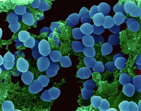 Enterococcus faecium .